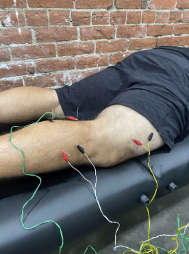 Dry needling used to reduce muscle tension and improve knee movement after injury