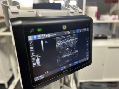 Musculoskeletal ultrasound assessment of ankle joint and peroneal tendons