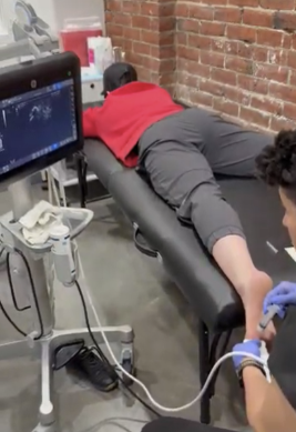 Cupping used to improve calf mobility and support recovery from Achilles pain