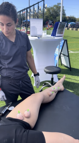 Cupping used to improve calf mobility and support recovery from Achilles pain